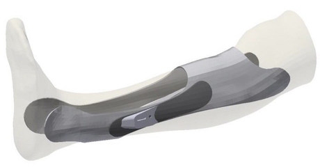 個性化加固設計的軟件工具，個性化加固設計軟件工具，精準定制，強化安全 行業(yè)新聞 第3張